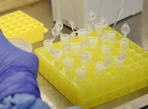 diagnostico_laboratorial_de_casos_suspeitos_do_novo_coronavirus_2801209411.jpg