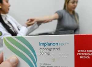 implanon.jpg