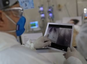 radiografia_de_torax_coronaviruscovid-19_hospital_sao_paulo1205200326.jpg